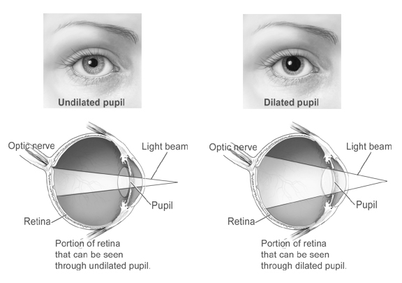 dilated vs undilated eyes